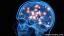 Jak Parkinsonova nemoc ovlivňuje mozek
