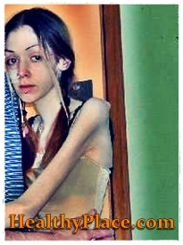 Na této sebepoškozující fotografii se dívka s anorexií také zapojuje do sebepoškozování tím, že udeří a pohmoždí části jejího těla